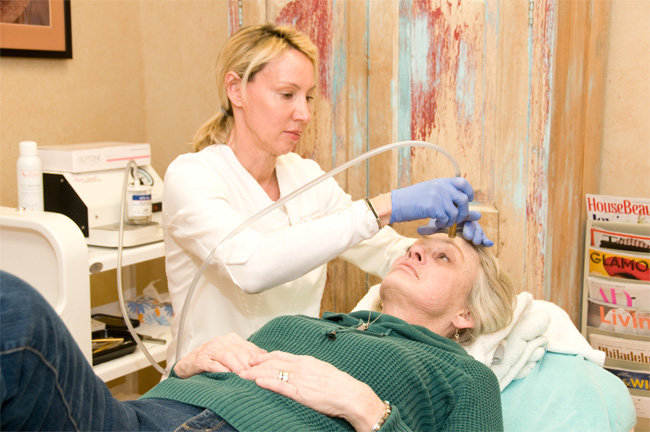 Patient receiving microdermabrasion treatment in Philadelphia, PA & Havertown, PA
